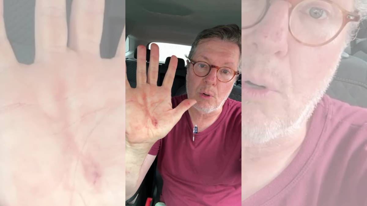 Jornalista sofreu um corte na mão durante a tentativa de assalto