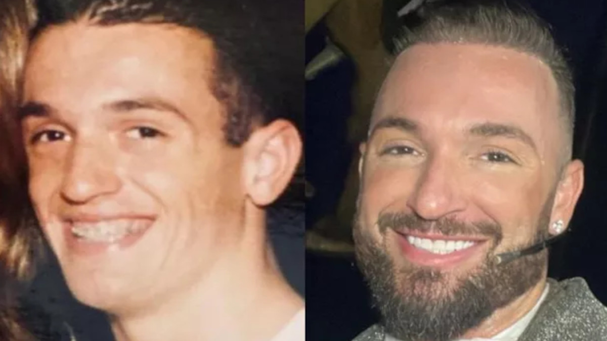 Diego Hypolito antes e depois de seus procedimentos estéticos