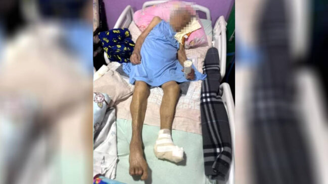 Delegacia Especial de Repressão aos Crimes por Discriminação (Decrin) do Distrito Federal investiga a amputação do pé de uma idosa de 103 anos