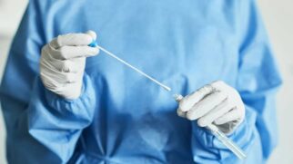 Em 2024, foram registrados 1.126 casos de Mpox no estado de São Paulo, sem nenhum óbito associado à doença
