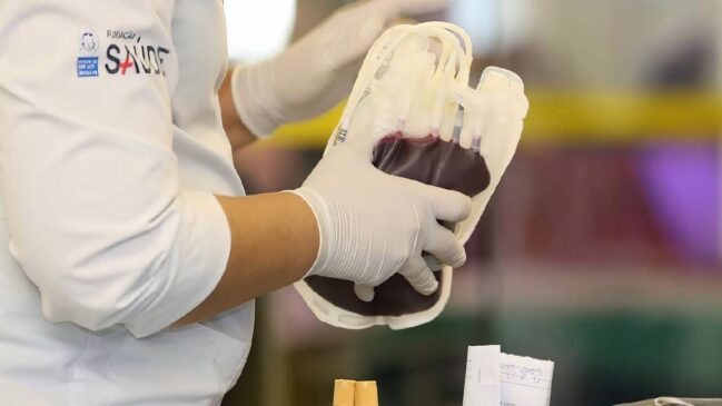 Cerca de 60 mil brasileiros vivem com a doença no Brasil