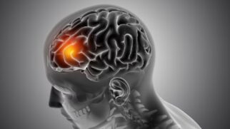 Mês de maio também é conhecido como 'Maio Vermelho', para conscientizar sobre o Acidente Vascular Cerebral (AVC)