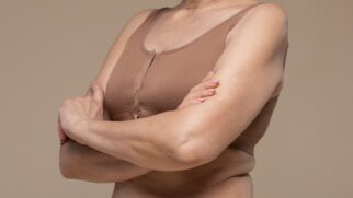 Descubra como se livrar da flacidez nos braços com estratégias simples