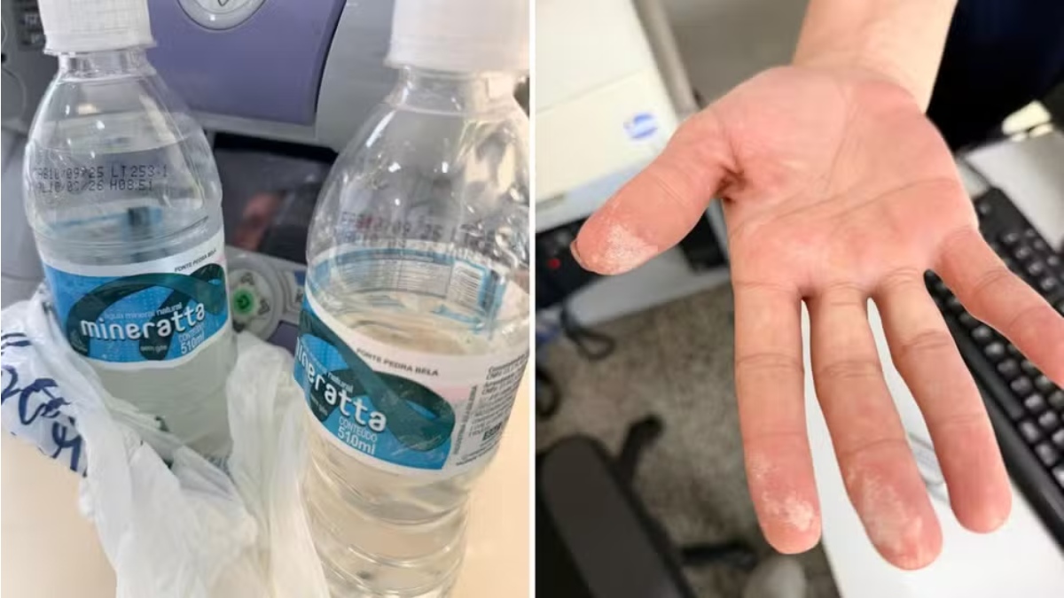 Vítima estava trabalhando quando pegou a garrafa de água da marca Mineratta lacrada na geladeira da sala de reuniões