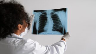 Especialistas alertam que sinais ignorados, inclusive nos dedos, podem ser indícios precoces do tumor