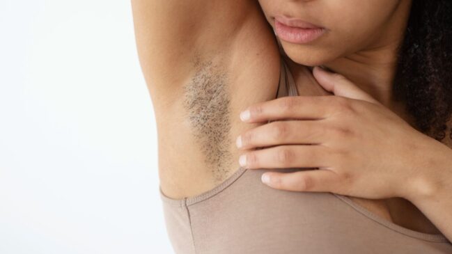 Lâmina, cera, inflamações e fatores hormonais estão entre as causas; depilação a laser e dermocosméticos podem ajudar no clareamento