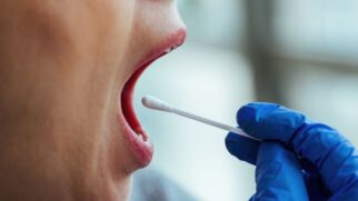 Doença afeta a saliva, a gengiva e até a cicatrização, e pode ser percebida antes de outros sintomas