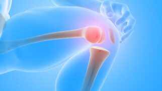 Quer evitar a osteoporose? O primeiro passo é abandonar este hábito comum na sua rotina