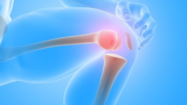 Quer evitar a osteoporose? O primeiro passo é abandonar este hábito comum na sua rotina