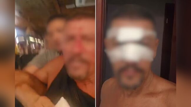 Empresário foi agredido dentro de um estabelecimento na Praia Grande (SP)
