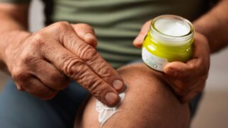 Produtos como babosa e rosa-mosqueta ajudam, mas não garantem ausência de cicatriz; veja orientações médicas