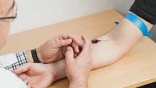 A análise reuniu múltiplos estudos e apontou que a versão plasmática da proteína reflete processos neurodegenerativos ligados à doença