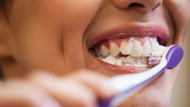 Ideal é usar uma escova de cerdas macias, movimentos suaves e fio dental diariamente, sem machucar