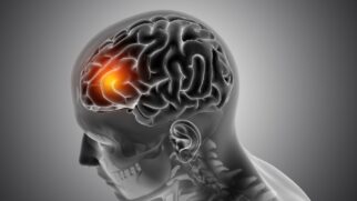 Com o envelhecimento da população e o avanço dos casos de demência, estratégias acessíveis como o treinamento cerebral ganham destaque como aliadas na prevenção do Alzheimer e na promoção de um envelhecimento mais saudável.