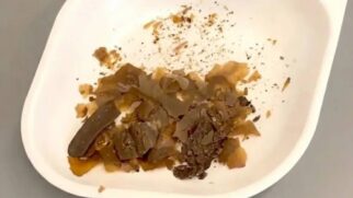 Resíduos indicam mistura com fezes humanas, tomilho e azeite usada como preparo medicinal