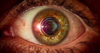 Ao considerar a evolução histórica da oftalmologia de lentes de vidro a cirurgias e próteses a nanotecnologia se apresenta como um passo importante rumo a uma nova era de tratamentos visuais