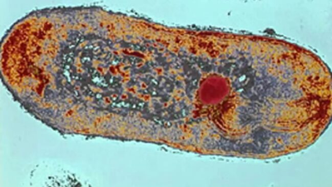 Os sinais de infecção podem variar de acordo com o órgão infectado pela bactéria
