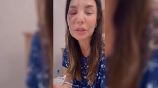Segundo Ivete, o desmaio aconteceu em casa e provocou a queda que resultou na fratura facial