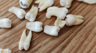 Hábito comum pode estar prejudicando seus dentes sem você perceber