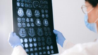 A pesquisa analisou uma amostragem de adultos entre 18 a 49 anos