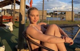 Virginia diz que foi diagnosticada com alopecia e relata nova queda de cabelo