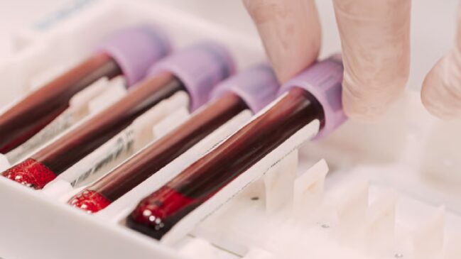 O exame possui maior eficiência nas fases iniciais do tumor