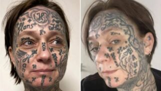 Holandesa de 52 anos passou por procedimentos para remover as tatuagens