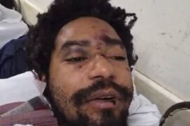 Ator Diego Souza Moreira sofre hemorragia após ser vítima de ataque homofóbico em São Paulo
