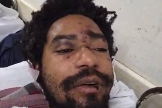Ator Diego Souza Moreira sofre hemorragia após ser vítima de ataque homofóbico em São Paulo