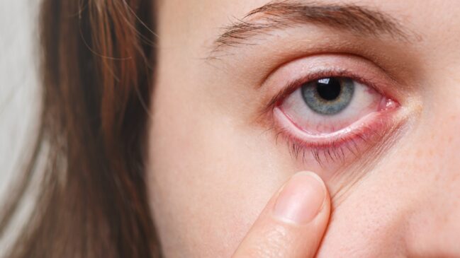 Tremor involuntário nas pálpebras é uma sensação incômoda que pode afetar qualquer pessoa, independentemente da idade.