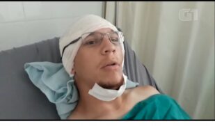 O surfista Vinícius Cavalcanti, de 31 anos, morador do local, foi mordido no rosto enquanto surfava na praia Cacimba do Padre