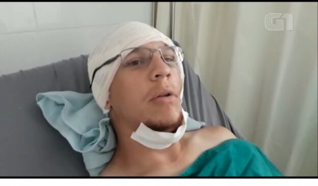O surfista Vinícius Cavalcanti, de 31 anos, morador do local, foi mordido no rosto enquanto surfava na praia Cacimba do Padre