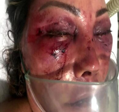 Elaine Caparróz, de 55 anos foi espancada durante quatro horas pelo advogado Vinícius Batista Serra, de 27 anos, em 1º encontro