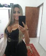 A suspeita é que foi injetado silicone industrial nos glúteos da atendente de lanchonete, Dayane Rodrigues da Silva, de 25 anos