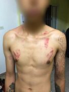 Fotos mostram que o estudante de 16 anos tem diversos ferimentos espalhados no rosto, pescoço, peito, braços e costas