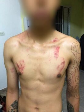 Fotos mostram que o estudante de 16 anos tem diversos ferimentos espalhados no rosto, pescoço, peito, braços e costas