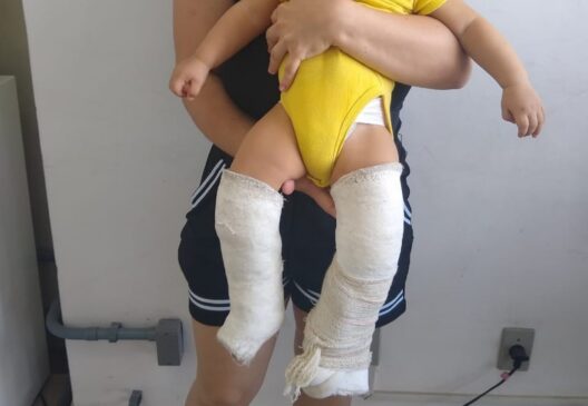 A Delegacia de Defesa da Mulher apurou que quando ele estava sozinho com o bebê teria torcido as pernas da criança até quebrá-las