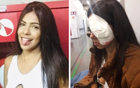 A mãe da adolescente de 16 anos conta: 'Tem horas que ela se revolta, diz que deveria ter morrido'