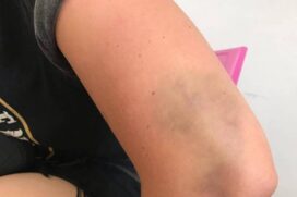 A fotógrafa conta que um dos agressores afirmou que uma das vítimas apanhou por ter cara de homem