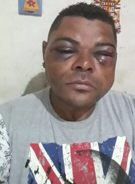 Homem de 43 anos registrou um boletim dizendo ter sido agredido por um médico na Unidade Pré-Hospitalar da zona norte de Sorocaba