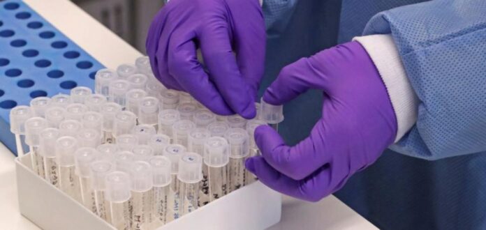 Cerca de 7 mil pessoas, com idade mínima de 18 anos serão testadas