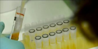 Hemocentro do Rio iniciou estudos com uso de plasmas de pacientes curados do coronavírus para tratar infectados graves