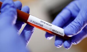 De acordo com a confedera&ccedil;&atilde;o, foram realizados 15.235 testes de infec&ccedil;&atilde;o pelo novo coronav&iacute;rus