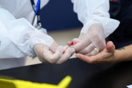 A cidade está aplicando um exame sorológico que mostra se a pessoa possui anticorpos contra a Covid-19