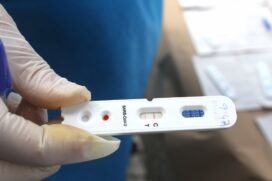 O teste é denominado como Neokit Covid-19 e poderá detectar a presença do vírus em menos de duas horas