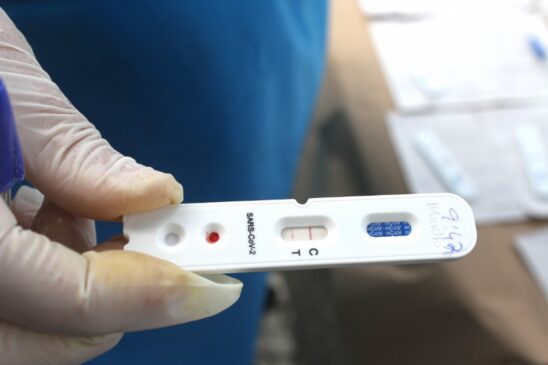 O teste é denominado como Neokit Covid-19 e poderá detectar a presença do vírus em menos de duas horas