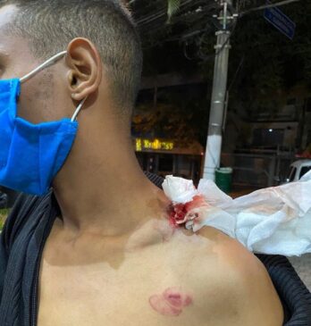 Vendedor ambulante é atingido por bala de borracha da PM no bairro do Jabaquara, na zona sul da Capital