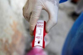 Cons&oacute;rcio Conectar, associado &agrave; FNP, pediu ao Minist&eacute;rio da Sa&uacute;de e &agrave; Anvisa libera&ccedil;&atilde;o da venda em farm&aacute;cias de testes de covid-19 para uso pr&oacute;prio