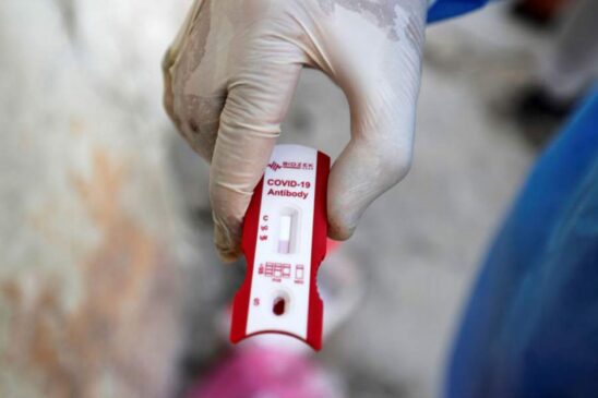 Consórcio Conectar, associado à FNP, pediu ao Ministério da Saúde e à Anvisa liberação da venda em farmácias de testes de covid-19 para uso próprio