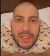 Caio Afiune, ex 'BBB 21', apareceu careca ap&oacute;s transplante capilar